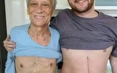 Son who donated part of his liver to his father unfortunately ends up fa…Son who donated part of his liver to his father unfortunately ends up fa…