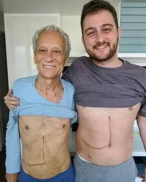 Son who donated part of his liver to his father unfortunately ends up fa…Son who donated part of his liver to his father unfortunately ends up fa…