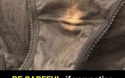 Why Underwear Discoloration Can Be a Sign of Health Changes