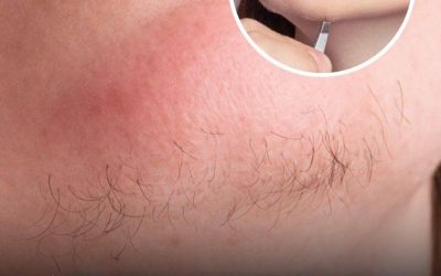 A woman’s chin hair is a sign of…See more