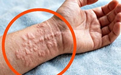 These Are Consequences of Sleeping With…