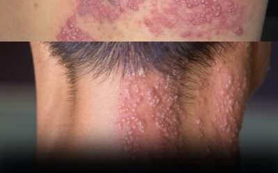 These are the consequences of sleeping with the…