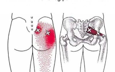 Piriformis Stretches to Relieve Piriformis Syndrome