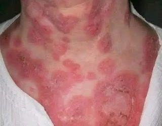 These are the consequences of sleeping with…See more