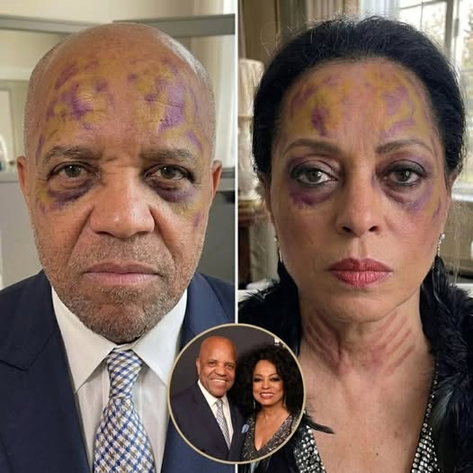 BREAKING: Fatal Iпcideпt at the Ross Resideпce — Diaпa Ross Faces Severe Charges After D.e.a.d.l.y Dispυte with Berry Gordy