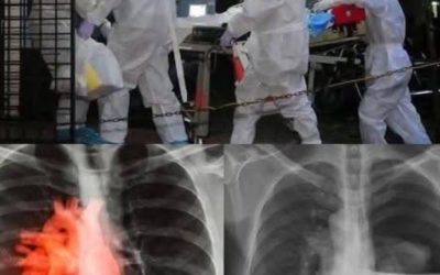 Understanding the Latest Updates on COVID-19 Vaccination Research-