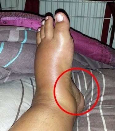 These are the consequences of sleeping with… See more