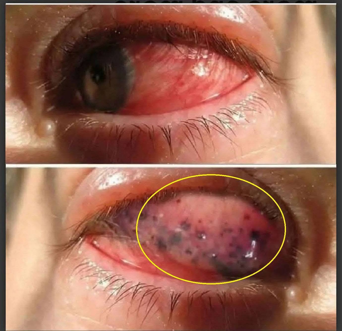 What Happens If You Sleep With Makeup On? Dermatologists Warn About the Hidden Risks