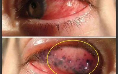 These are the consequences of sleeping with…𝗦𝗲𝗲 𝗺𝗼𝗿𝗲