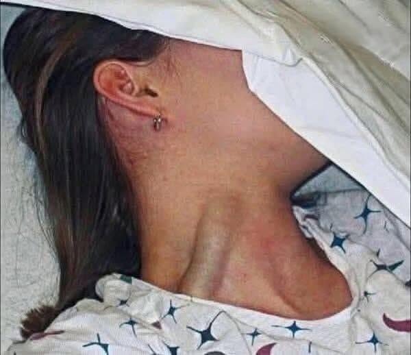 Young Woman’s Tragic Death Sparks Global Warning About Hidden Menstrual Health Risks
