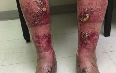 These are the consequences of sleeping with…See more.