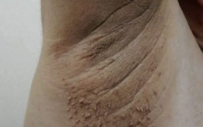 These are the first symptoms of cr…See more