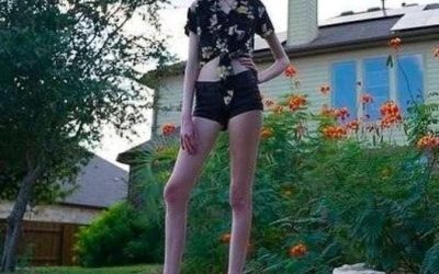 17-Year-Old Phenomenon Breaks World Record Thanks to Remarkably Long Legs