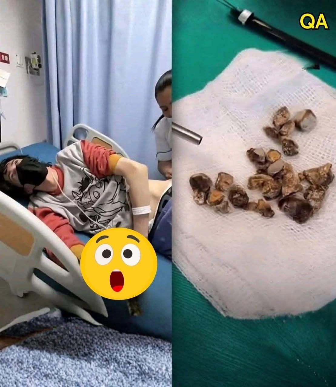 Man hospitalized after allowing himself to be penetrated… See more