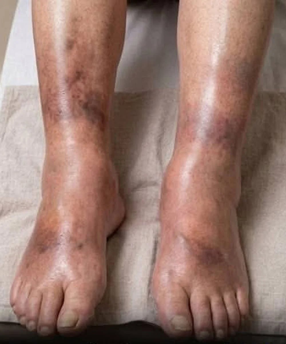 These are consequences of sleeping with…