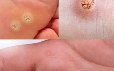 Pay attention — this symptom could mean an infection. Check the first comment👇