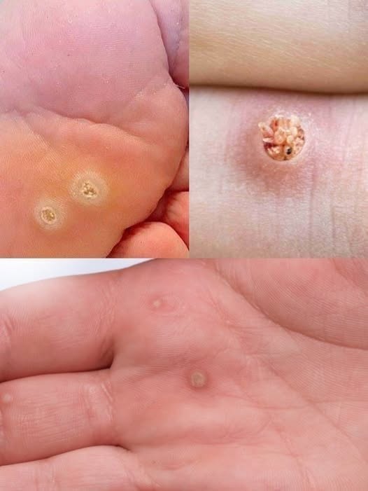 Pay attention — this symptom could mean an infection. Check the first comment👇