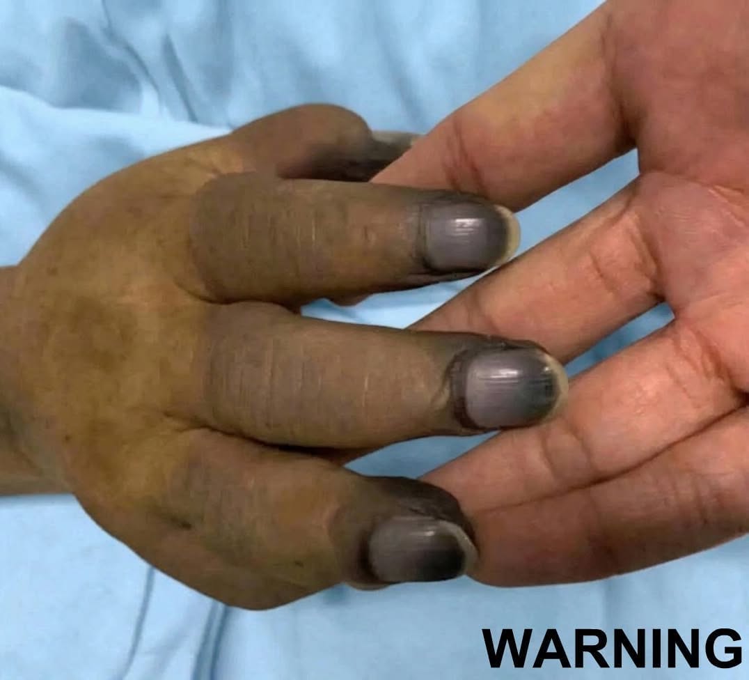 These are the consequences of painting your nails with…