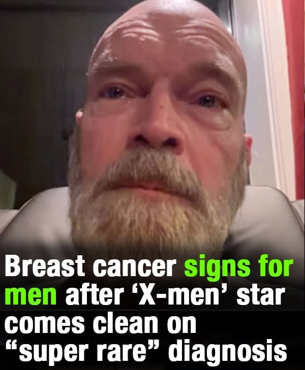 Breast cancer signs for men after ‘X-men’ actor comes clean on “super rare” diagnosis