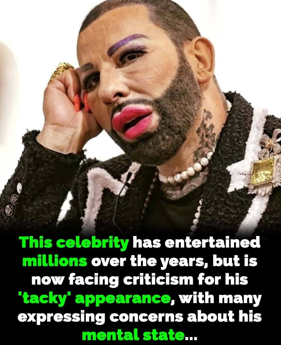 This celebrity has entertained millions over the years, but is now facing criticism for his ‘tacky’ appearance, with many expressing concerns about his mental state…