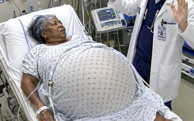A 65-year-old woman was stunned to discover she was pregnant—but when the time came to give birth, the doctor’s examination revealed something that left everyone in shock.