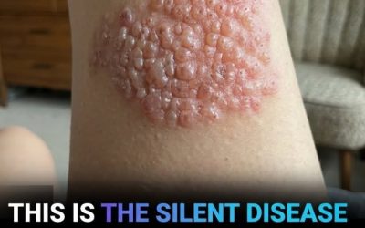 Doctors Warn: This Silent Virus Can Reactivate Years Later and Cause Severe Lasting Pain