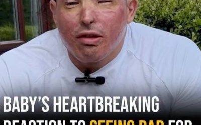 A Father’s Worst Nightmare: After a Horrific Acid Attack Left Him Unrecognizable, Would His Own Toddler Still Love Him?