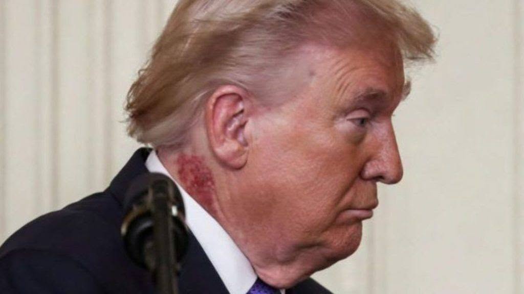 Reports Concerning Donald Trump’s Health Gain Attention Following Schedule Changes