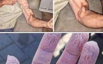 Man Stretches His Arm — Doctors Say This Is What Actually Happened