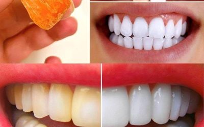 10 Natural Hacks to Whiten Your Teeth at Home in Just 3 Days (No Dentist Needed)