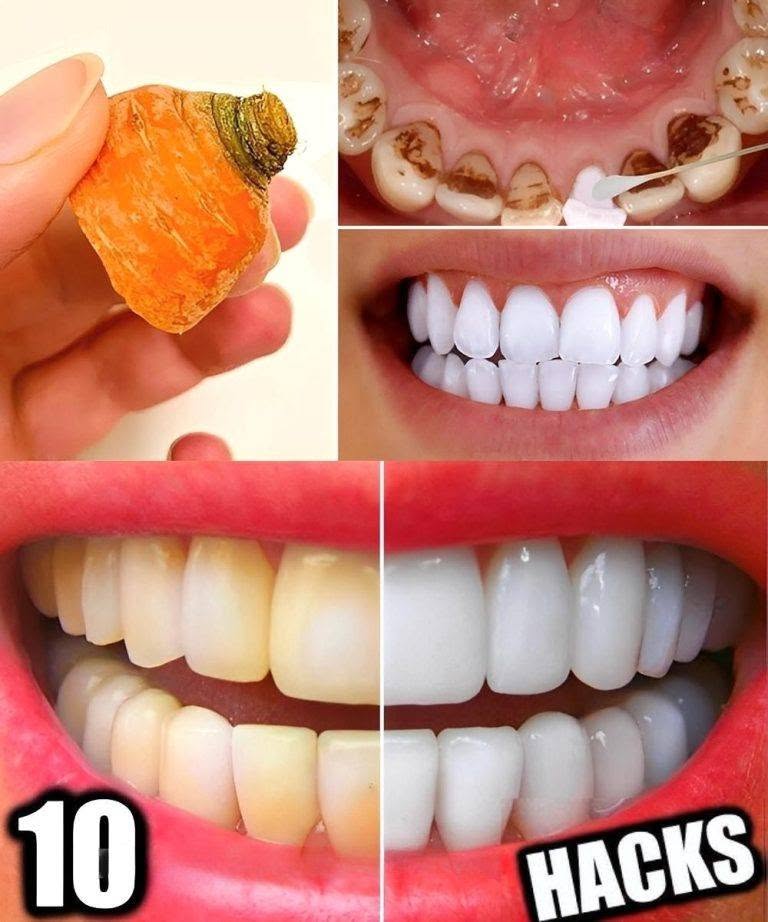 10 Natural Hacks to Whiten Your Teeth at Home in Just 3 Days (No Dentist Needed)