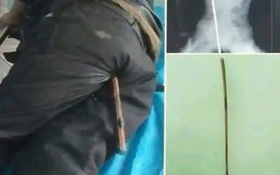 Young man hospitalized after being arrested….