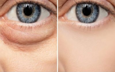 “You Won’t Believe What 5 Minutes Can Do to Your Puffy Eyes… ”