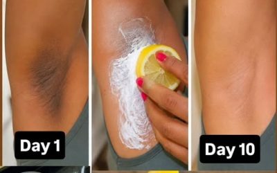 6 Home Remedies to Lighten Dark Underarms | How to get rid of Dark Underarms
