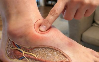 Medicinal Herbs: A Natural Solution to Reduce Swollen Feet and Improve Circulation