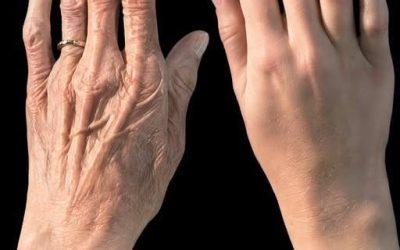 Look at this… these hands looked aged, full of spots… read more in first comment