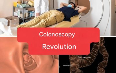 New method: colonoscopy will no longer be an invasive examination. (1/2)