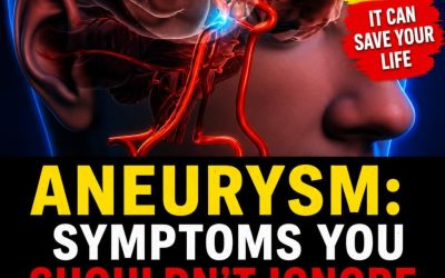 Aneurysm: Signs You Shouldn’t Ignore…