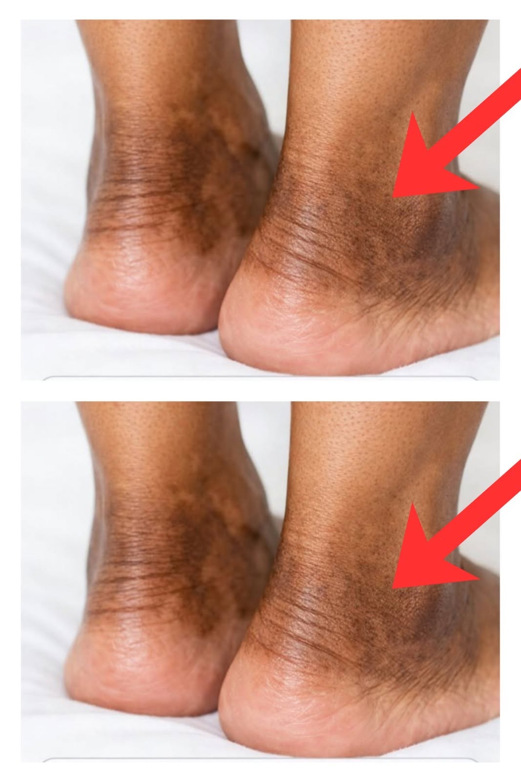 These are the first symptoms of a…