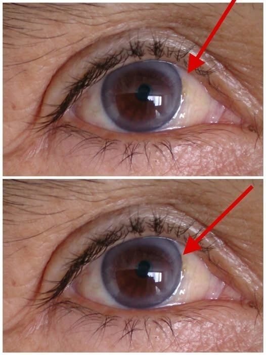 These are the first symptoms of a… See more