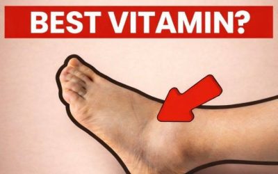 Top 5 nutrients to reduce swelling in feet and legs