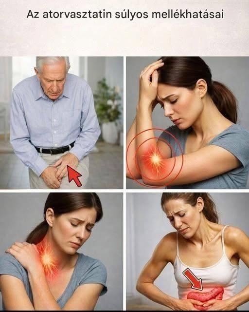 15 Hidden Side Effects of Atorvastatin Your Doctor May Never Talk About (and What You Can Do About Them Today)
