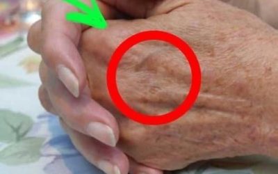 What do stains on the hands mean? see…