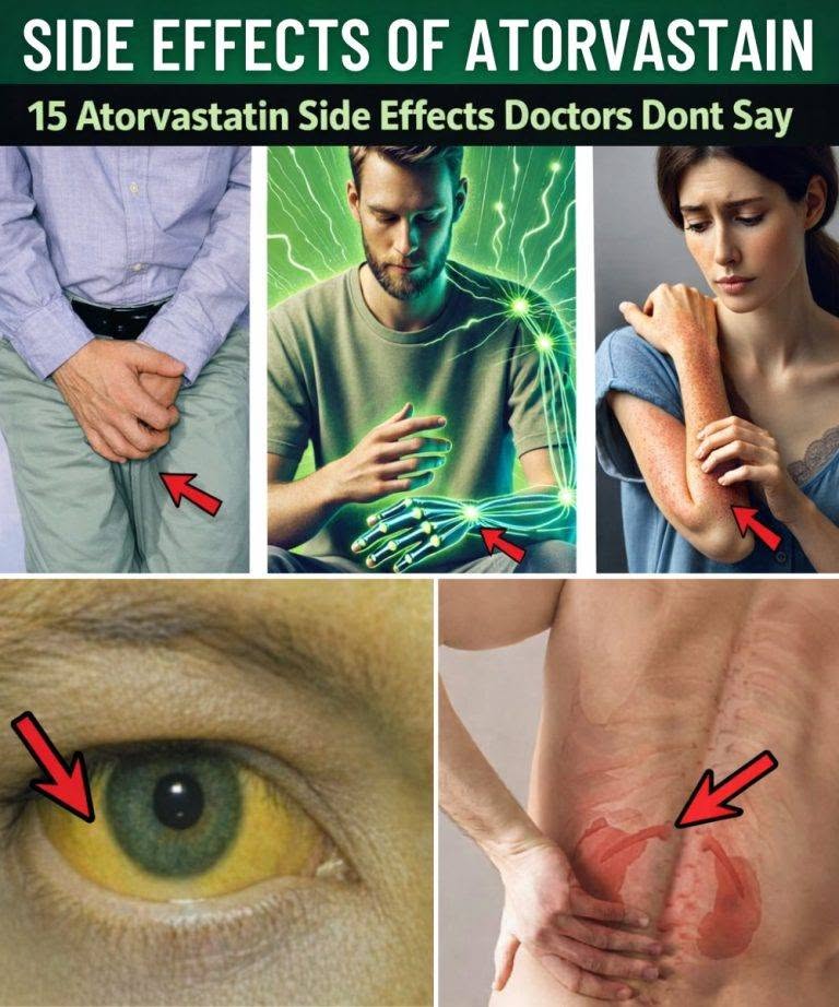 15 Potential Side Effects of Atorvastatin That Deserve Attention Before Your Next Prescription Refill