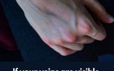 What the Veins on Your Hands Might Reveal About Your Liver Health