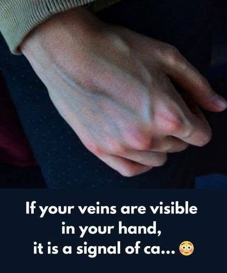 What the Veins on Your Hands Might Reveal About Your Liver Health