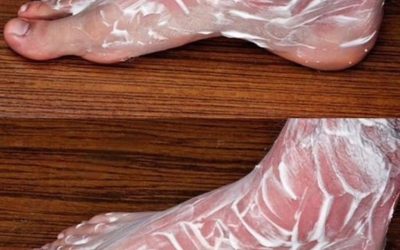 Get rid of bone and joint pain with this remedy