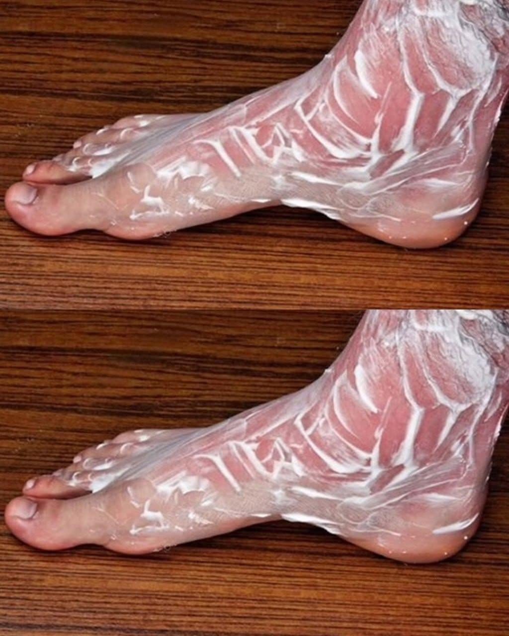 Get rid of bone and joint pain with this remedy