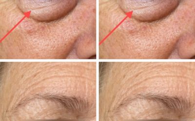 These are the first symptoms of a…