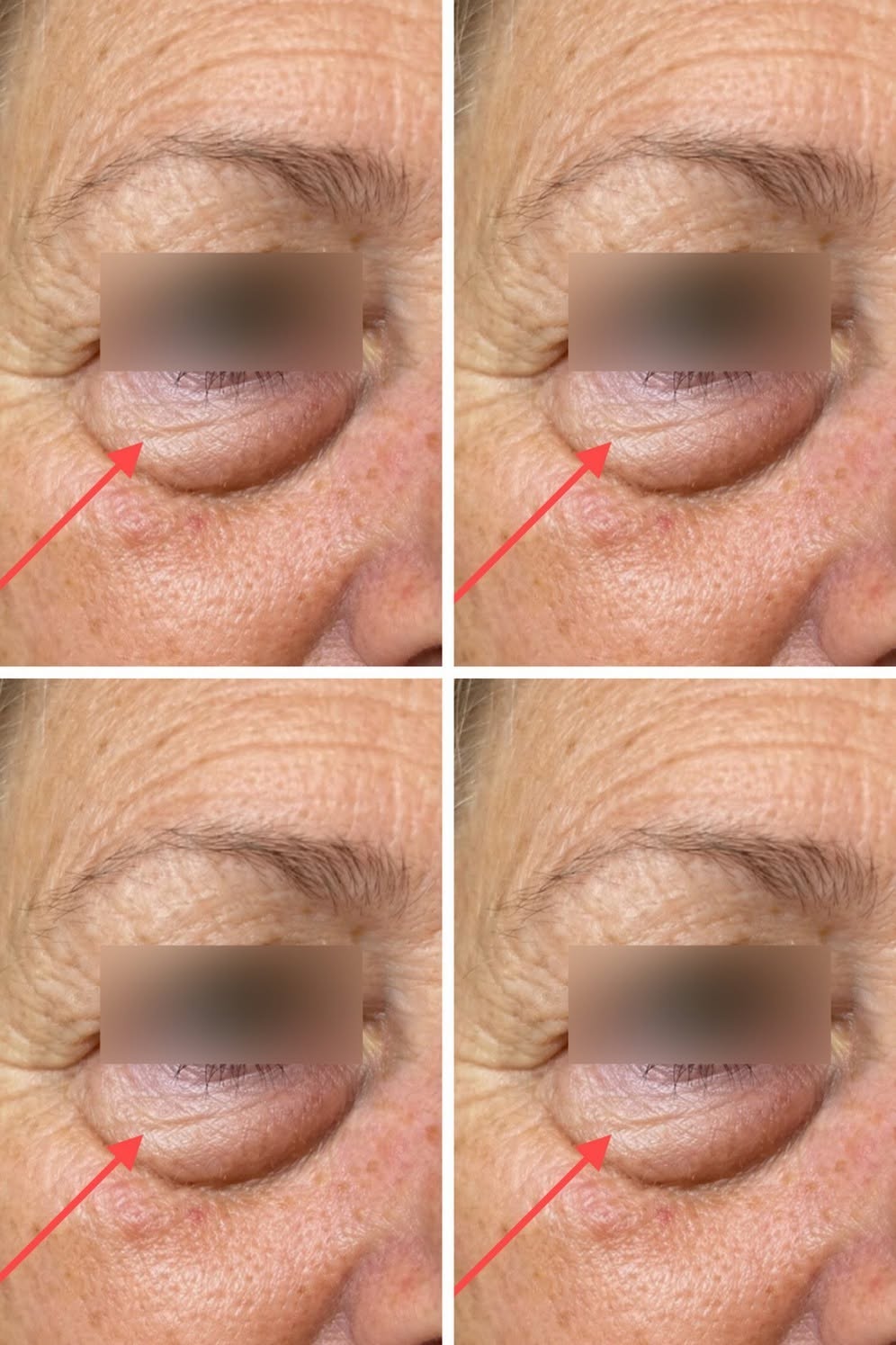 These are the first symptoms of a…